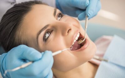 Routine Dental Checkups: Why do you Need it?